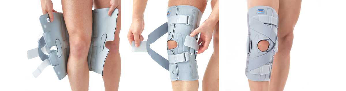 دعامة الرباط الجانبي الداخلي للركبة MCL